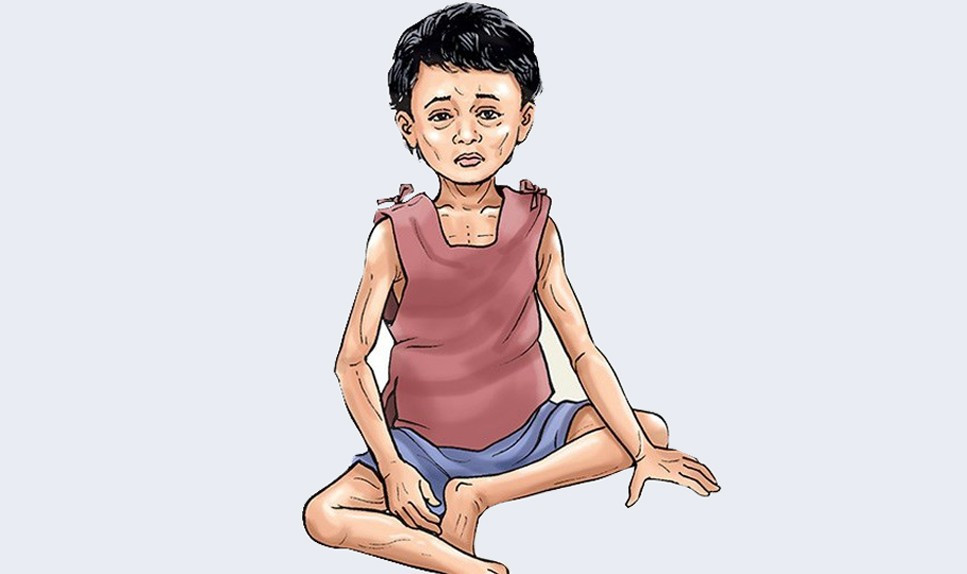 कुपोषित बालबालिकाको सङ्ख्या बढ्दै