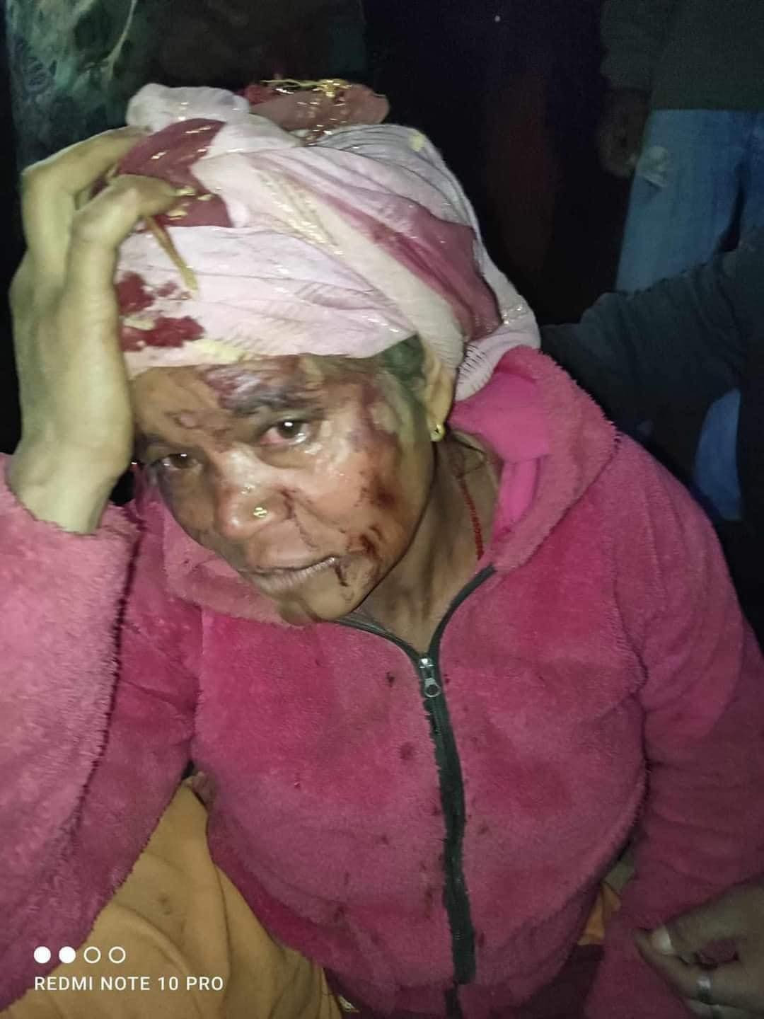 ६.४ म्याग्निच्युडको भूकम्पमा जाजरकाेटकाे खलङ्गा बजारमा ठुलो क्षती