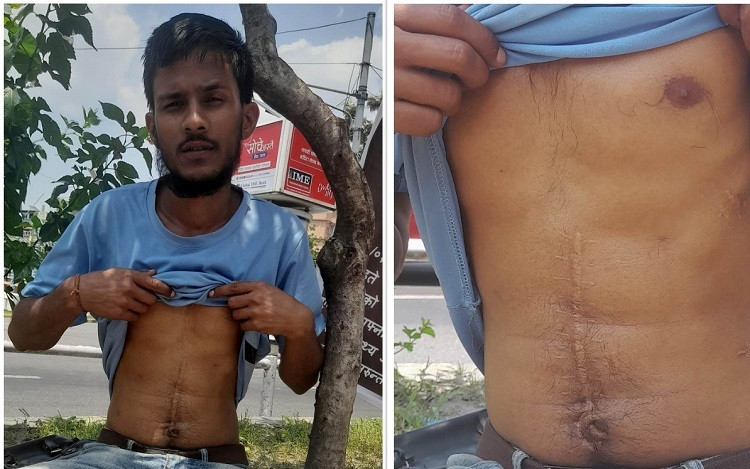 वीरेन्द्र जैसीले अनशन तोडे, उपचारको जिम्मा लिने गृहमन्त्रीको प्रतिबद्धता