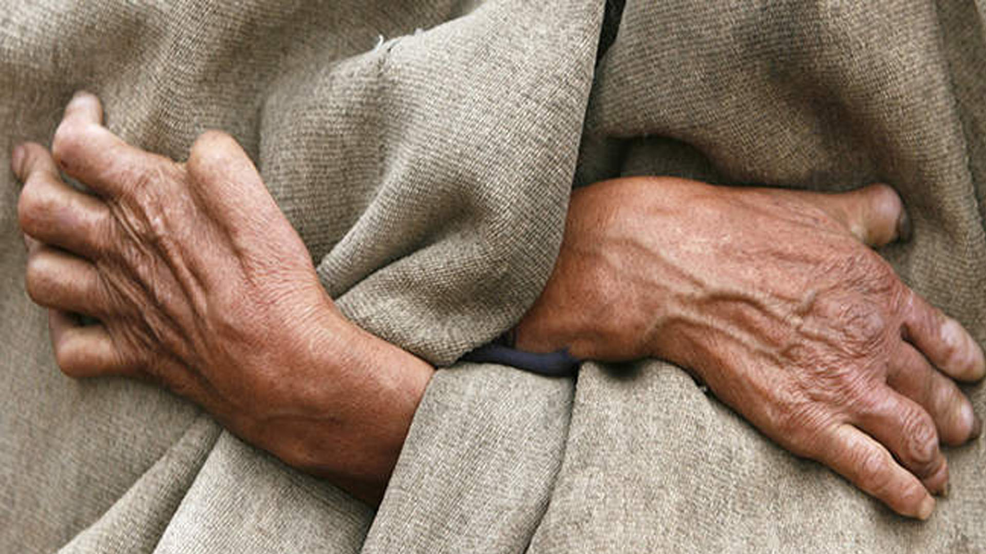 आज विश्व कुष्ठरोग दिवस